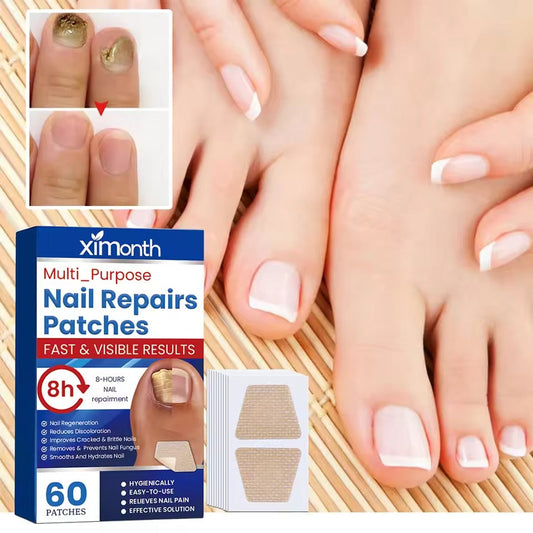 Fungal Nail Patches (60 pieces)