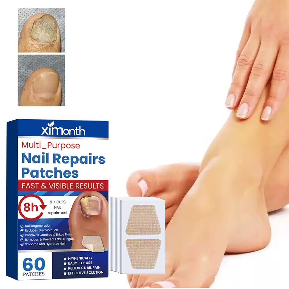 Fungal Nail Patches (60 pieces)