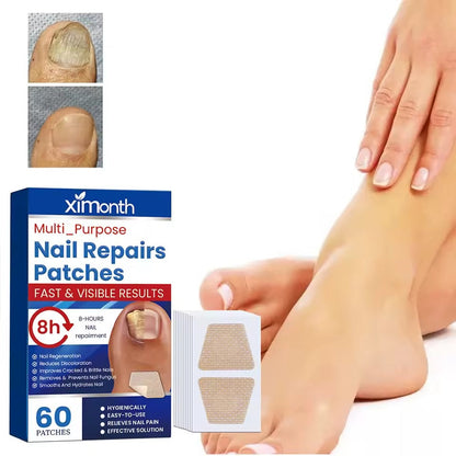 Fungal Nail Patches (60 pieces)